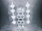 X-ray-1