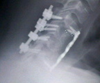 X-ray-2